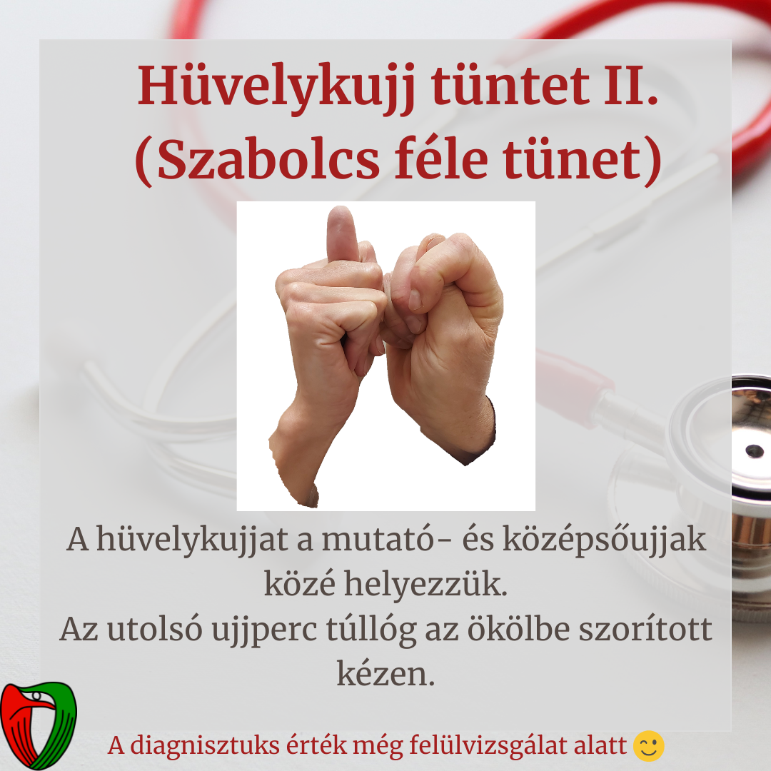 Betegk�nt �s orvosk�nt is fontos felismerni olyan testi t�neteket/fizikai adotts�gokat, melyek jelenl�te nagyban �sszef�gg a Marfan-szindr�ma megl�t�vel.