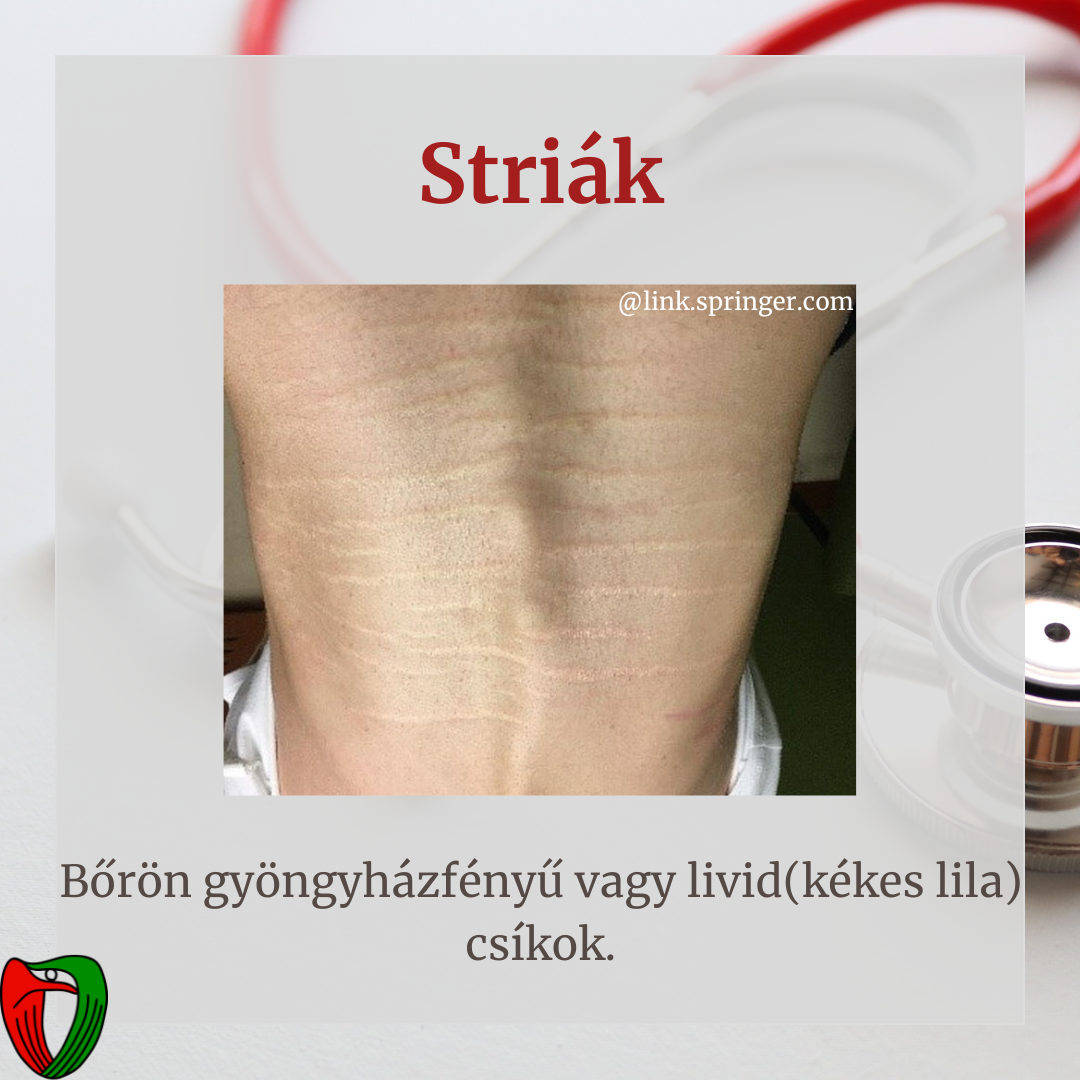 �nvizsg�lat mellett elengedhetetlen a szakorvosi vizsg�lat, mely a Marfan Ambulanci�n t�rt�nik!