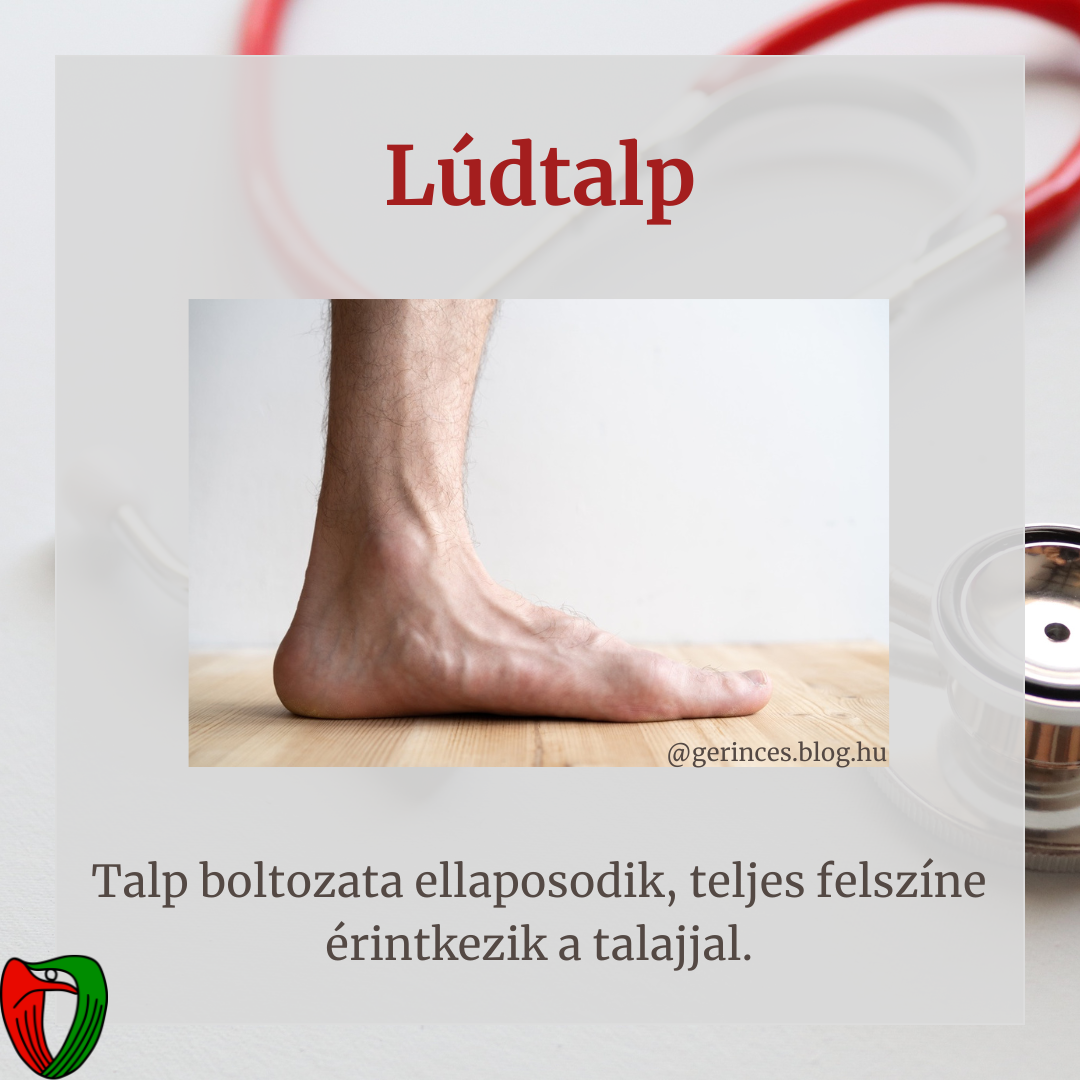 �nvizsg�lat mellett elengedhetetlen a szakorvosi vizsg�lat, mely a Marfan Ambulanci�n t�rt�nik!