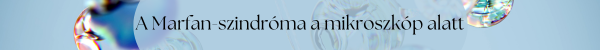 A Marfan-szindrma a mikroszkp alatt