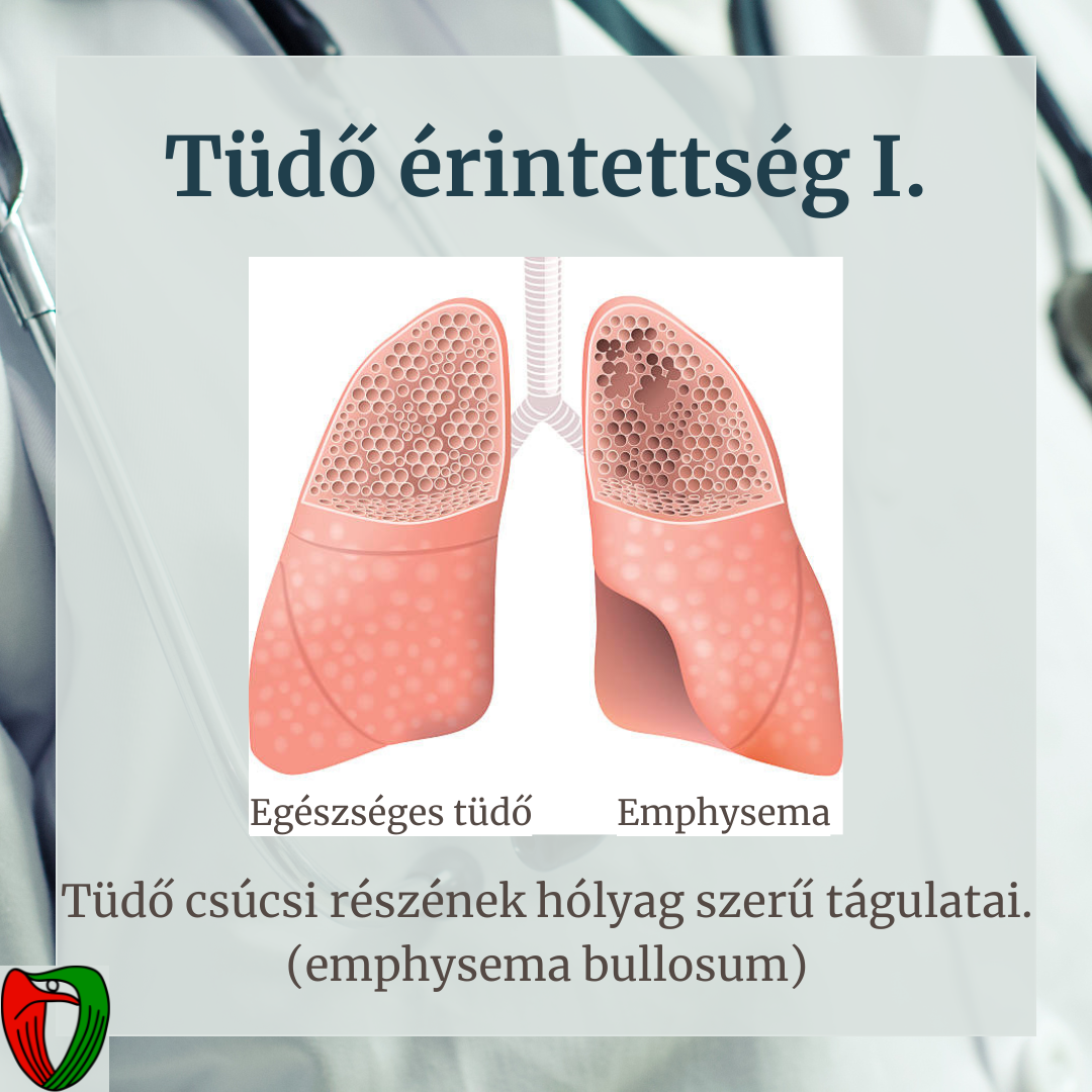 Sok olyan elt�r�s lehet a szervezet�nkben, amit mi magunk nem l�thatunk!