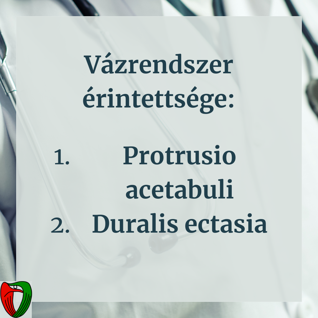 Emiatt m�g ink�bb fontos, hogy megfelel� szaktud�ssal rendelkez� orvosok is megvizsg�ljanak minket, ha felmer�l a gyan� a Marfan-szindr�ma megl�t�re!