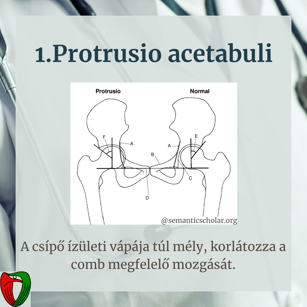 Ilyen esetben k�rj�k, b�tran keresse a Marfan Ambulanci�t!