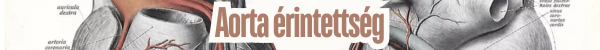 Aorta �rintetts�g