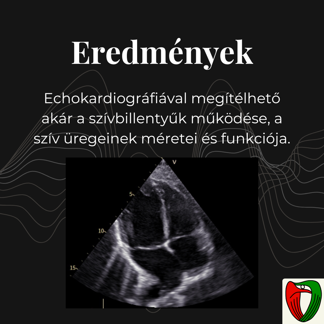 Echokardiogr�fi�val meg�t�lhet� ak�r a sz�vbillenty�k m�k�d�se, a sz�v �regeinek m�rete �s funkci�ja.