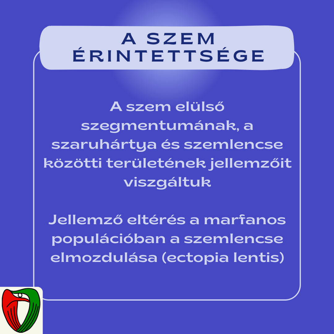 A tanulm�ny c�lja egy �tfog� szem�szeti sz�r�vizsg�lat megszervez�se, valamint a k�l�nb�z� genetikai mut�ci�val rendelkez� Marfan-szindr�m�s betegek szem�szeti jellemz�inek megismer�se volt.