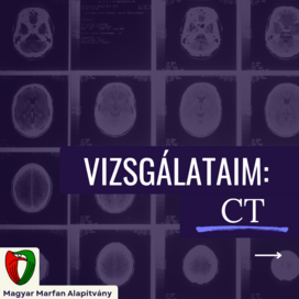 Vizsg�lataim: CT