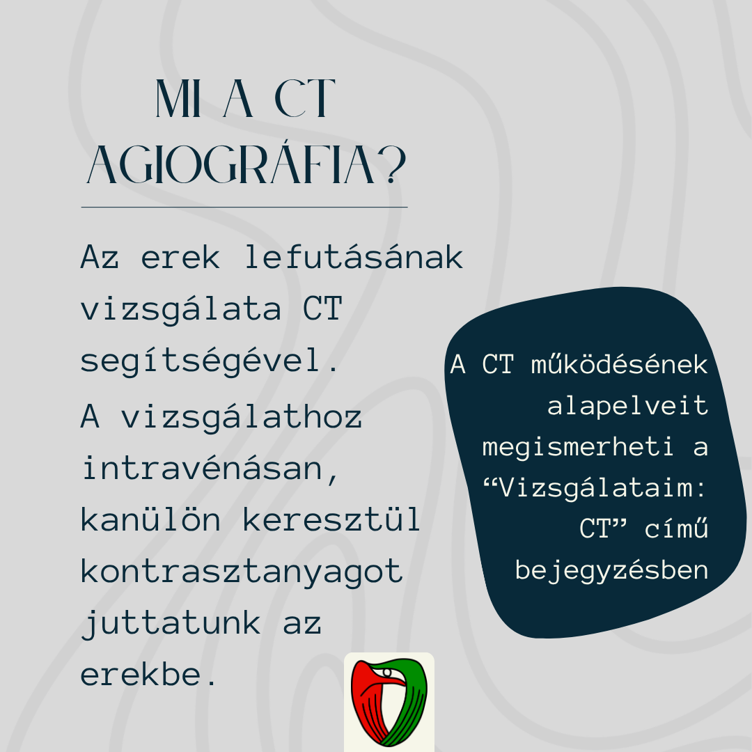 A k�palkot� vizsg�lat sor�n intrav�n�san, kan�l�n kereszt�l kontrasztanyagot juttatunk az erekbe. A CT m�k�d�s�nek alapelveit megismerheti a 